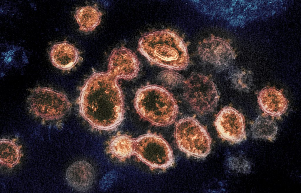 Coronavirus