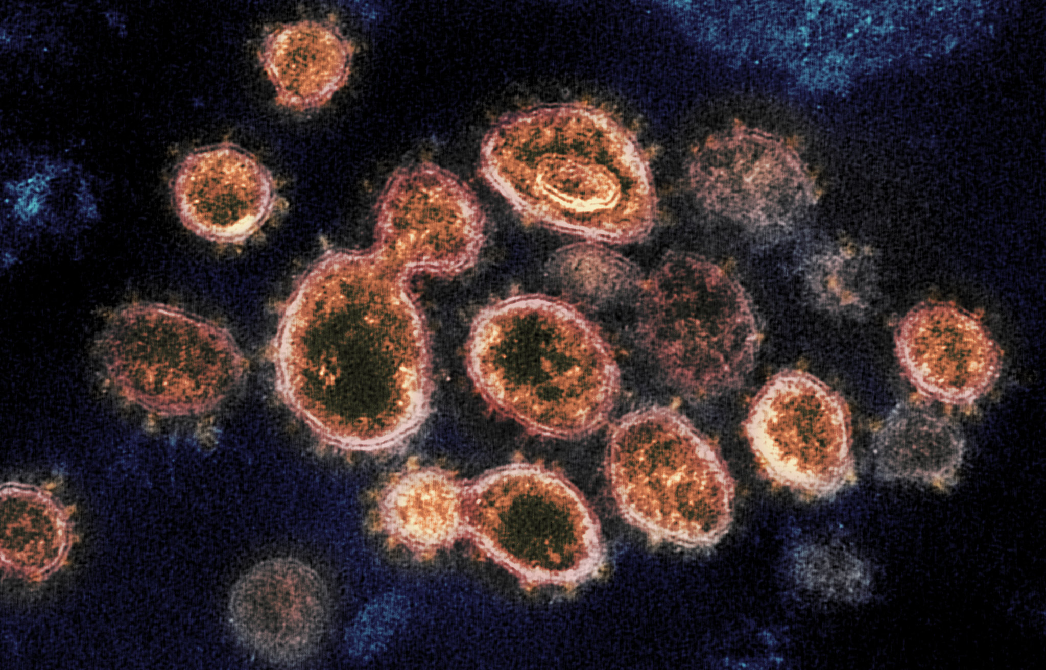 Coronavirus